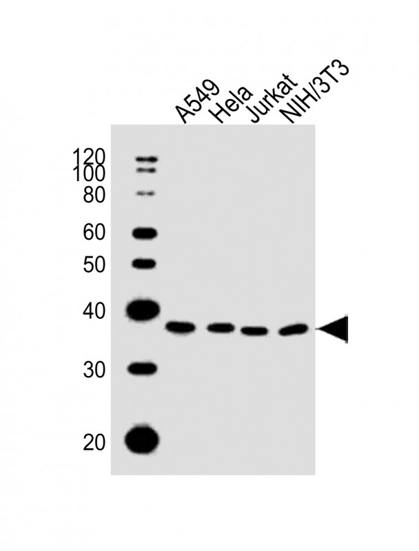 WB - DKK1 Antibody AW5504-U100